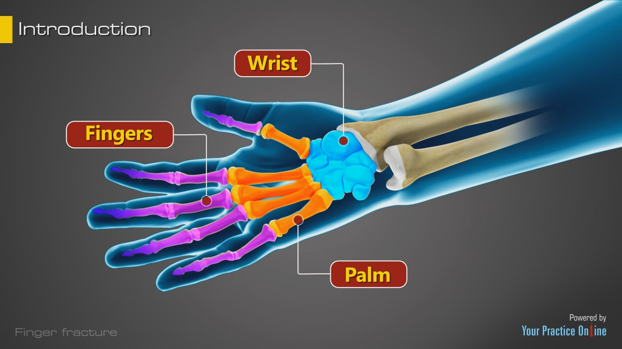 Finger Fractures Video Medical Video Library