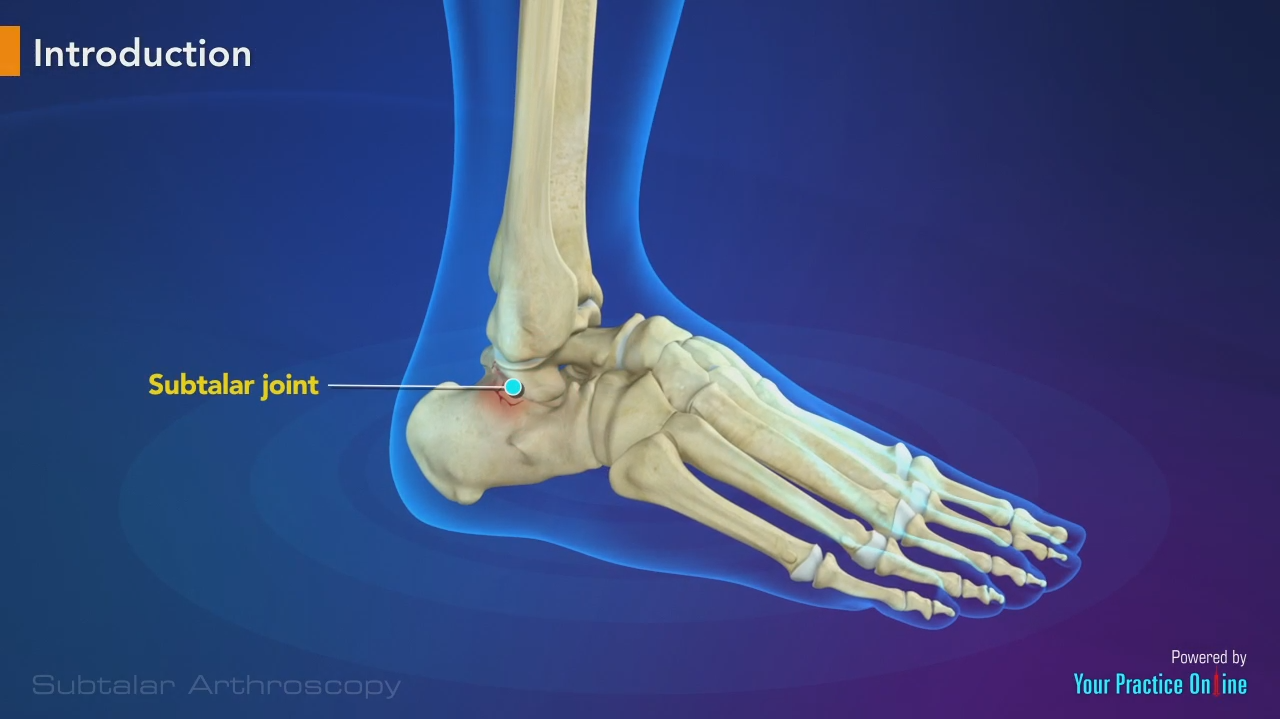 Subtalar Joint Movement