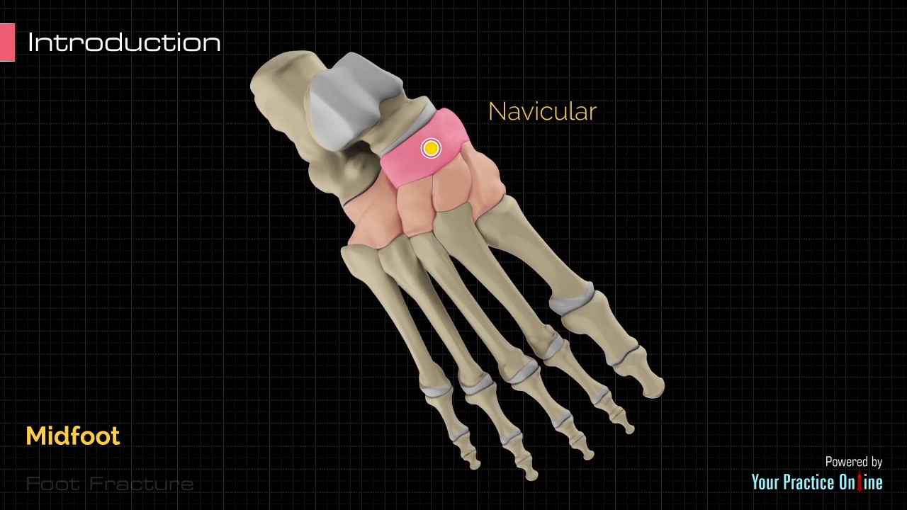 Foot Fracture video thumbnail