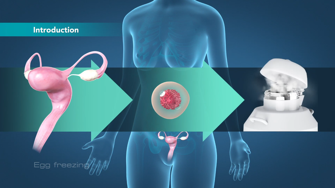 Egg Freezing Video Medical Video Library Egg Freezing Video Medical Video Library