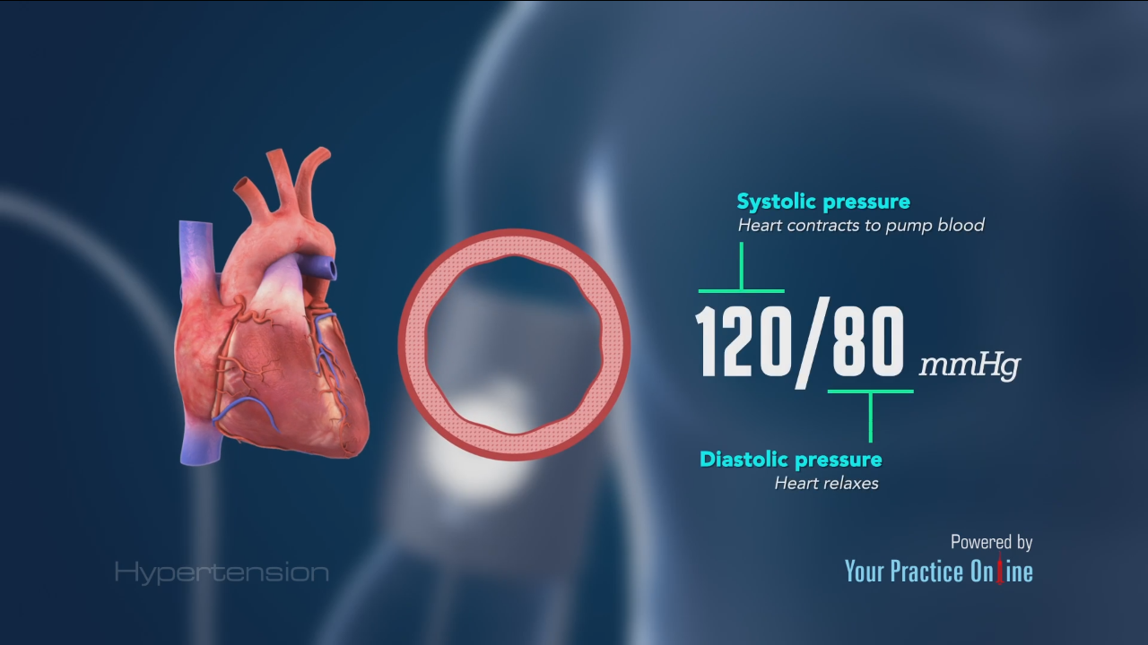 Hypertension Video | Medical Video Library