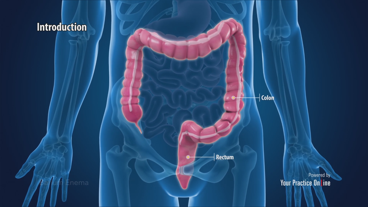 Bronchoscopy Procedure Video | What is Bronchoscopy | Lungs & Lymph Nodes Scan