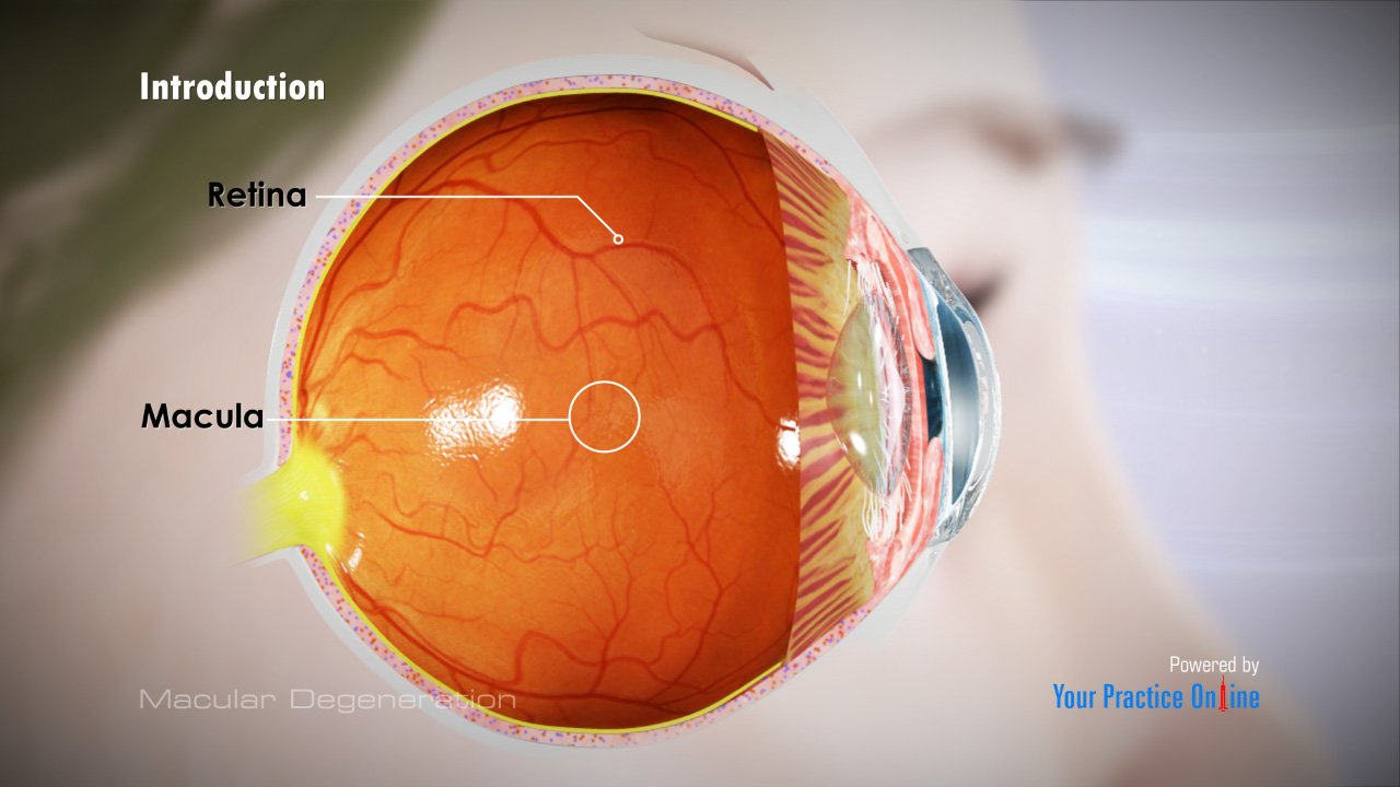 Macular Degeneration Video Medical Video Library