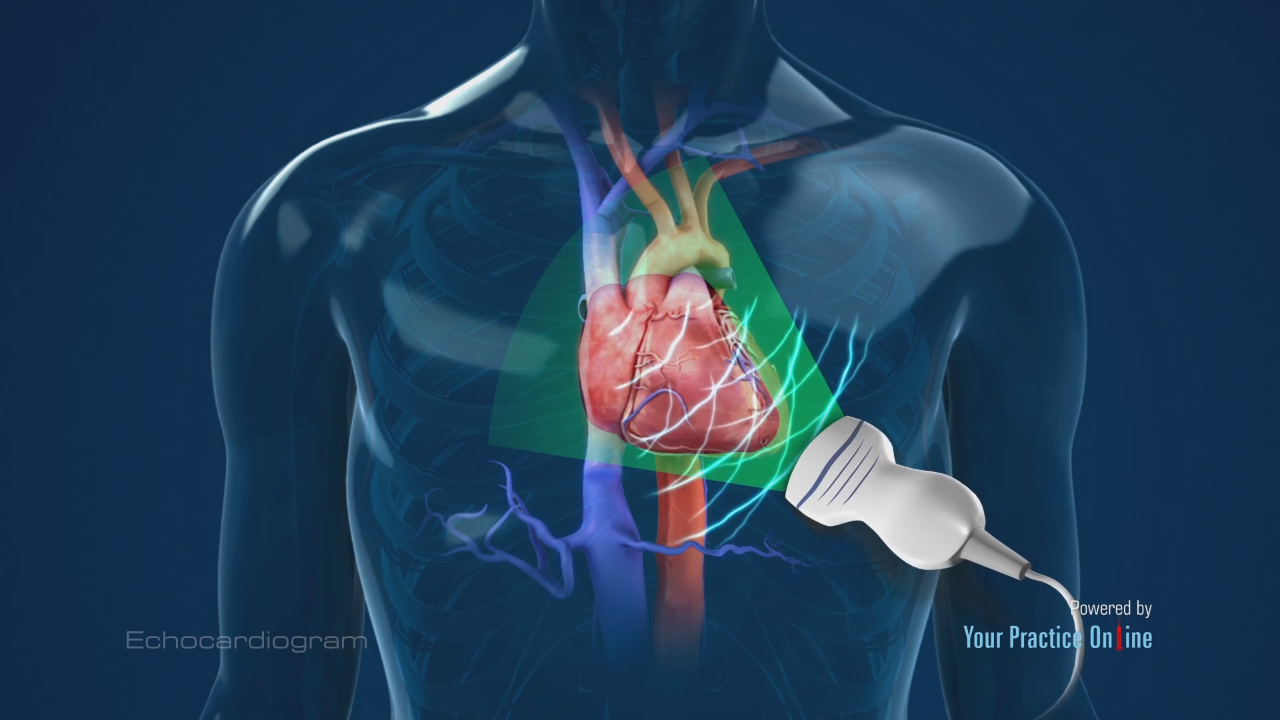 knoglebrud Afgang til Meningsfuld Echocardiogram Video | Medical Video Library