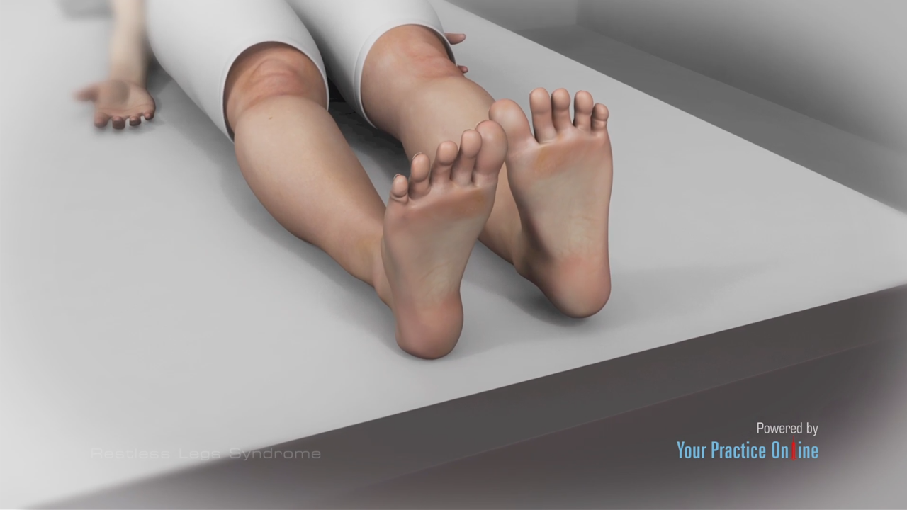 Restless Legs Syndrome Video | Medical Video Library