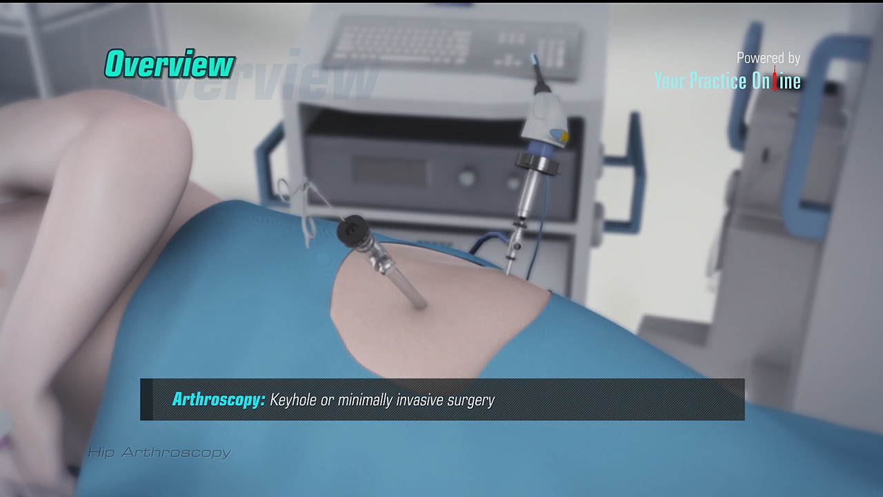 Hip Arthroscopy Video | Hip Surgery Procedures Video | Patient Education Library