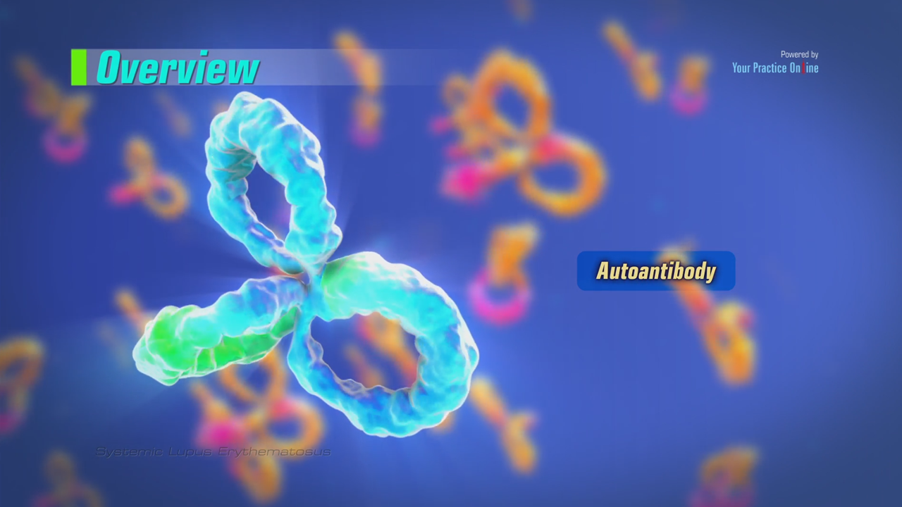 Systemic Lupus Erythematosus Video | YPO Education Systemic Lupus Erythematosus Video | YPO Education