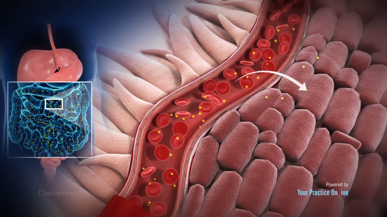 Diabetes Video | Medical Video Library