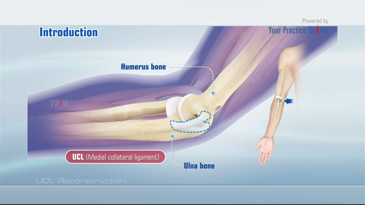 UCL Reconstruction Video Medical Video Library