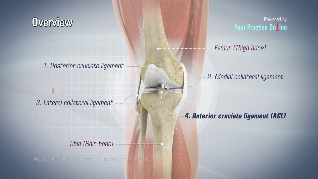 ACL Reconstruction Hamstring Method Video | Medical Video Library
