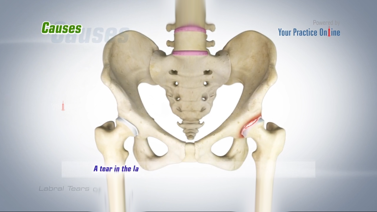 Hip Anatomy Video, Hip Orthopaedics Videos