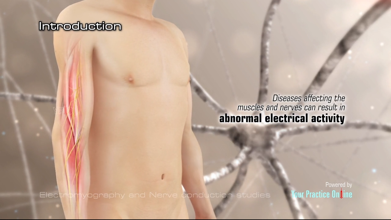 EMG Test Video | Never Disorders Testing | Electromyography Procedure Video