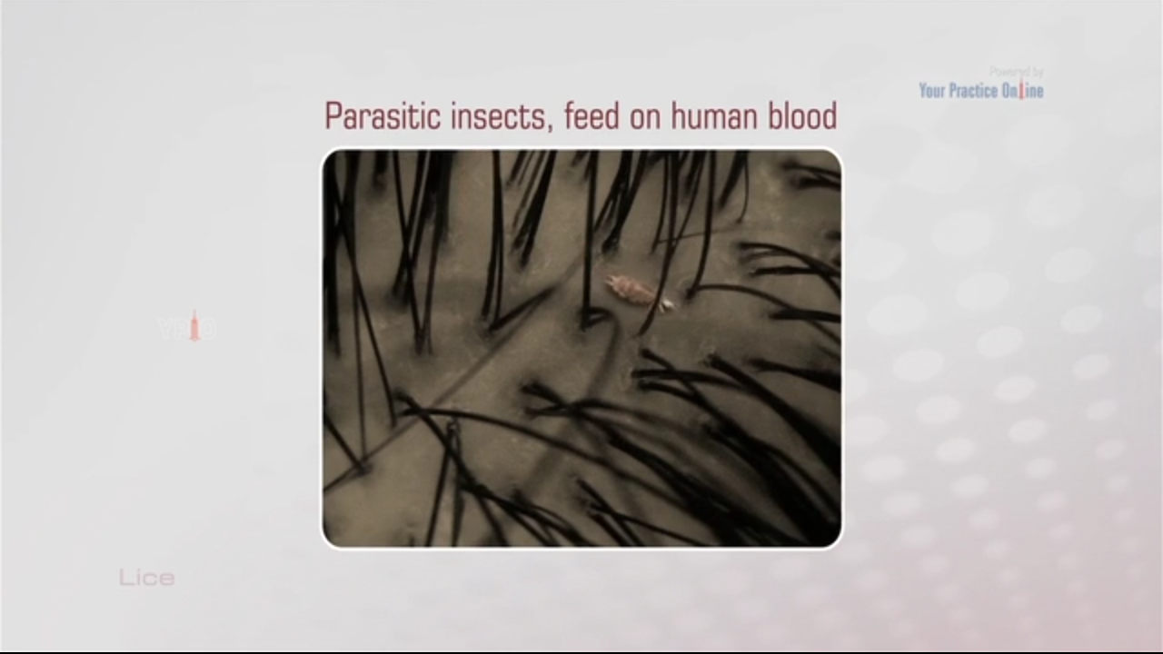 Head Lice Treatment Video | Lice Removal
