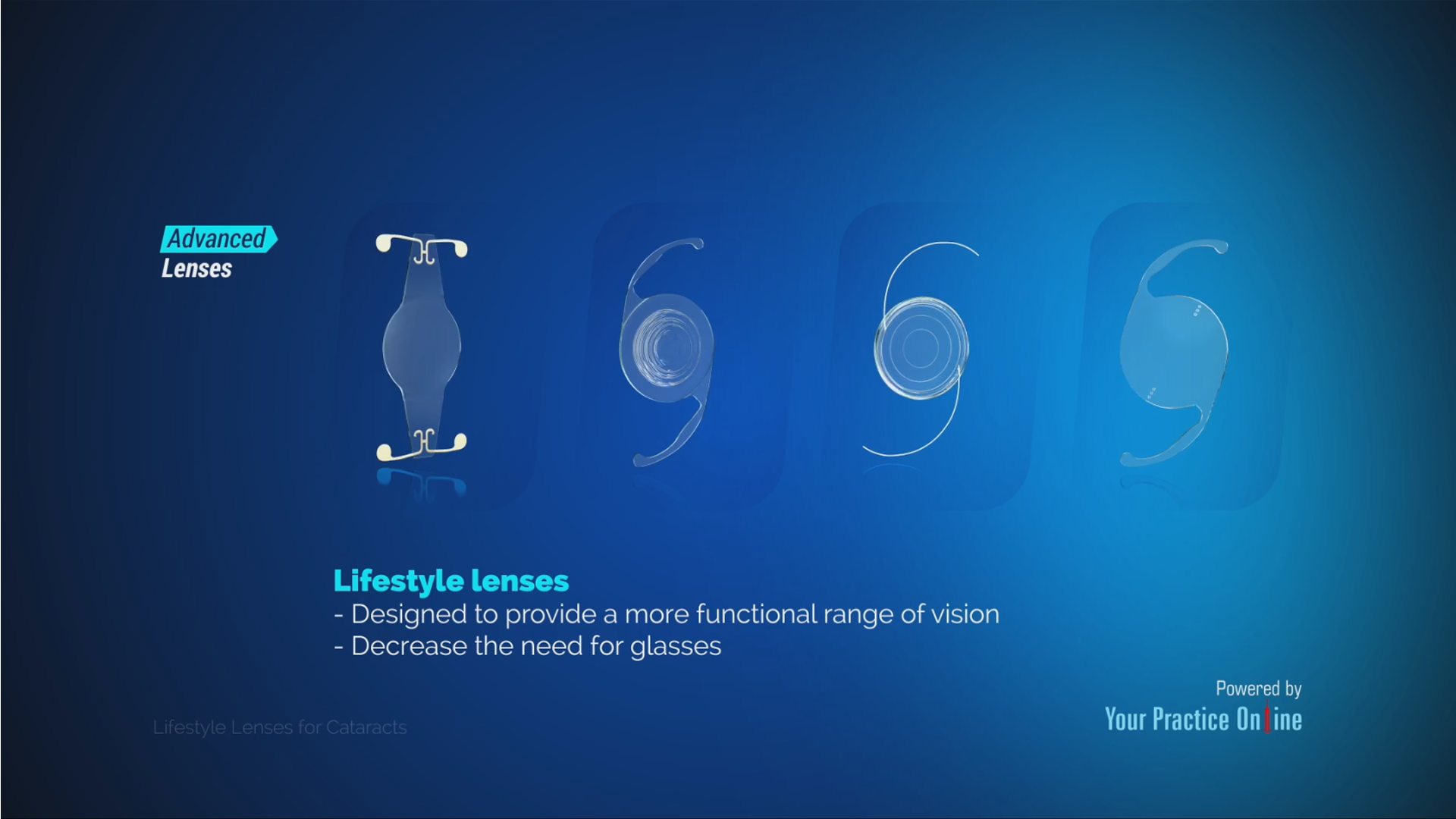Lifestyle Lenses for Cataracts Video | Medical Video Library