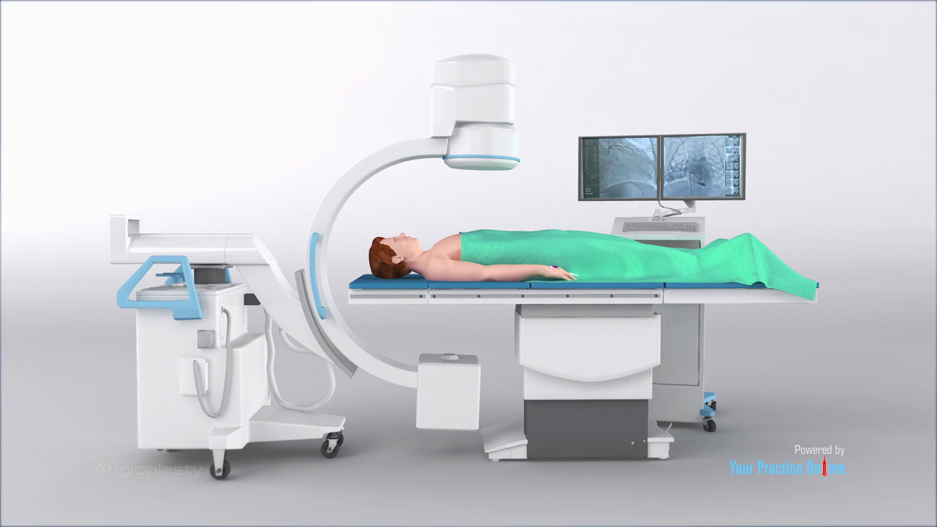 Angioplasty (Percutaneous Coronary Intervention) Video | Medical Video Library