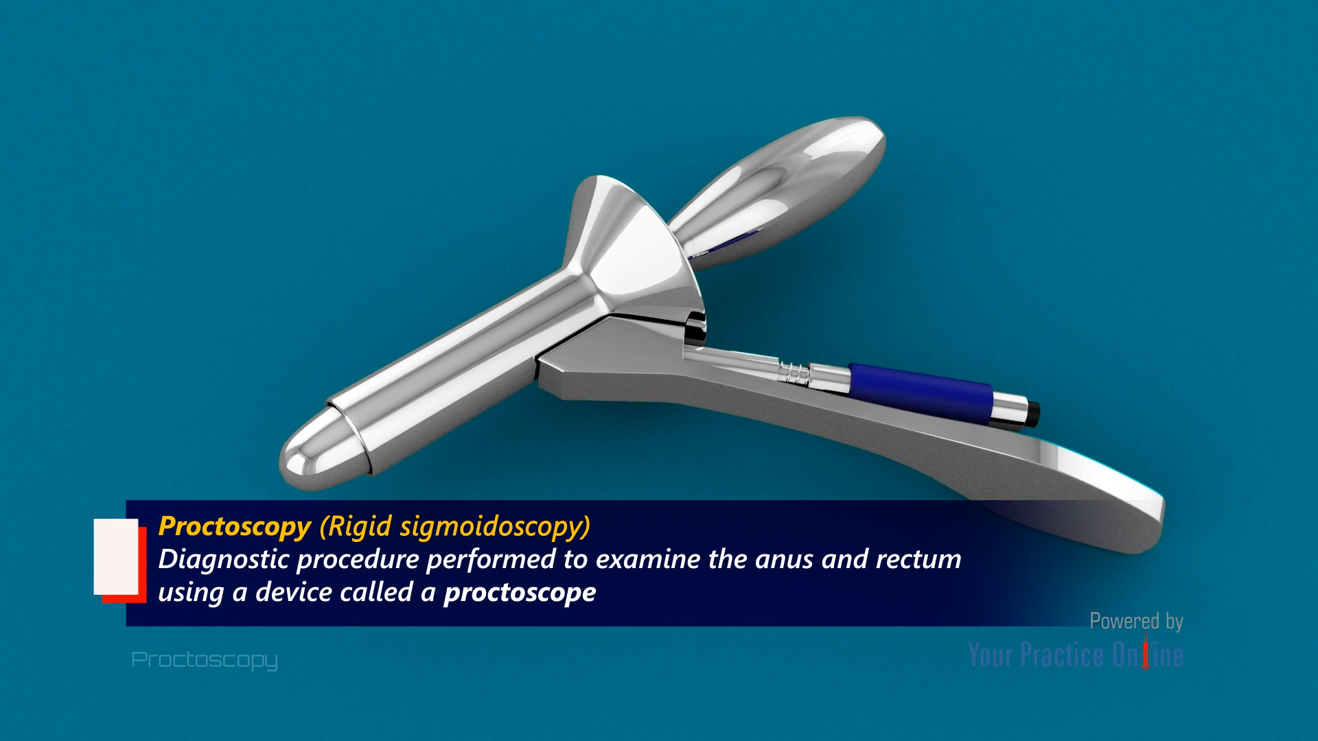 Proctoscopy Video Medical Video Library