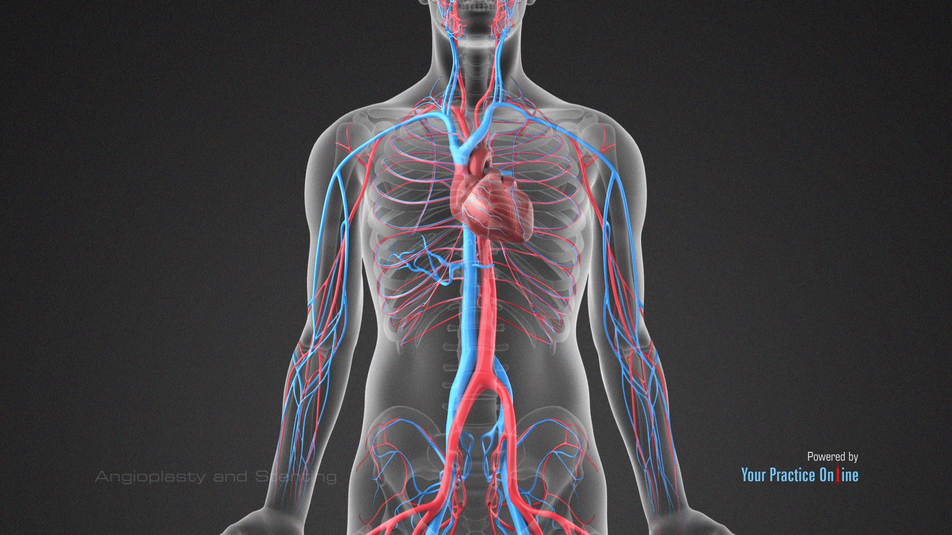 Angioplasty and Stenting (Vascular Surgery) Video | Medical Video Library Angioplasty and Stenting (Vascular Surgery) Video | Medical Video Library
