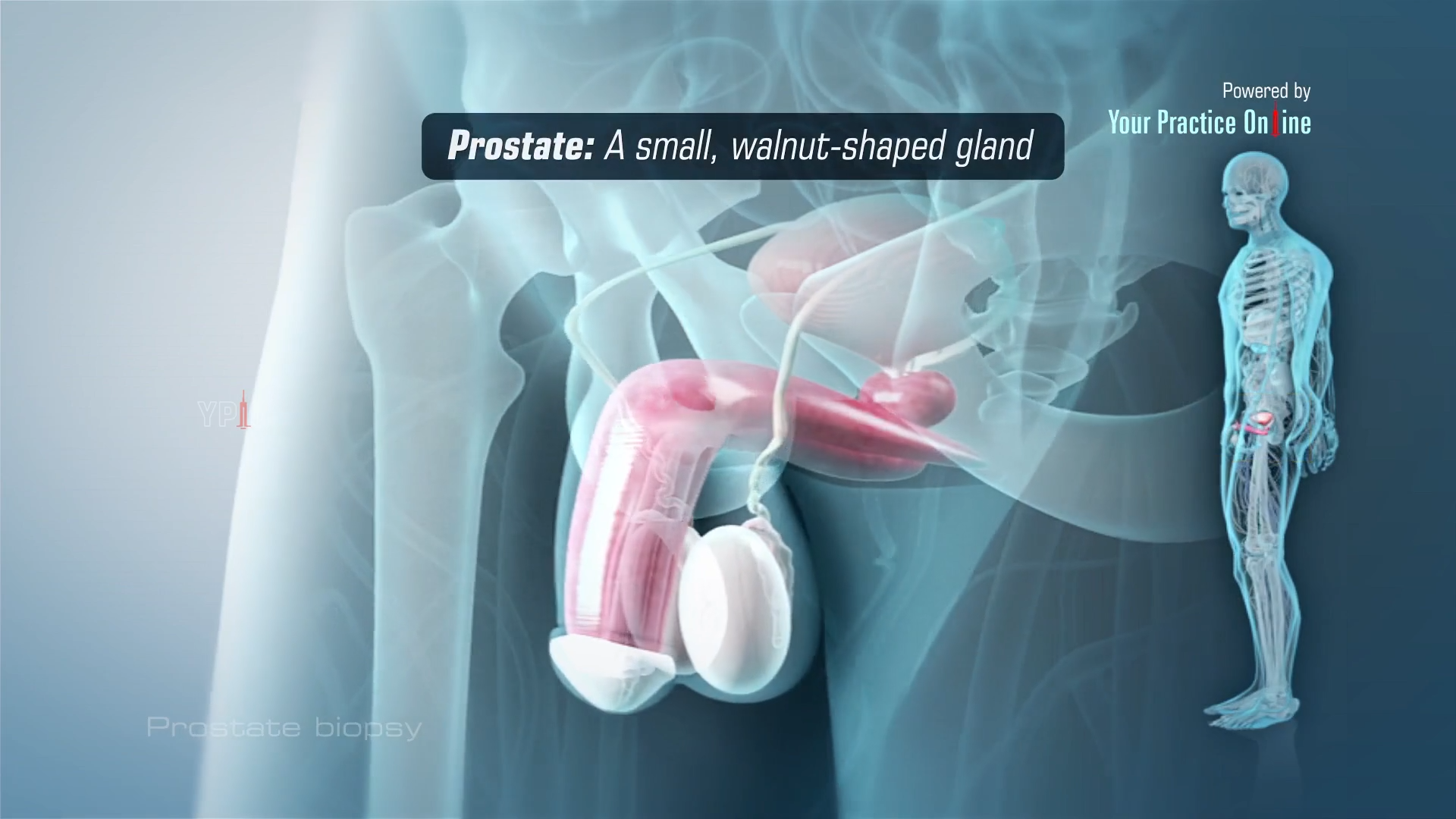 prostate 
