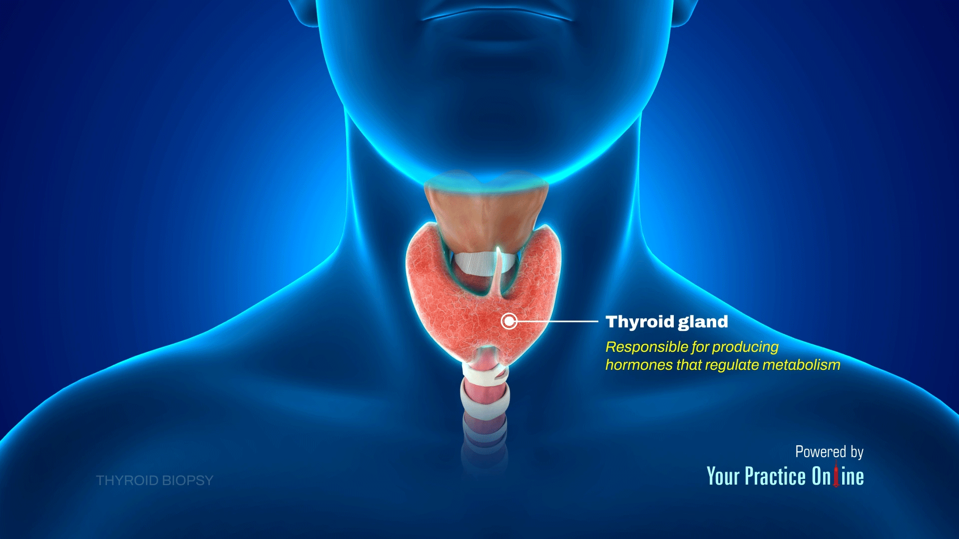 Thyroid Biopsy Video | Medical Video Library