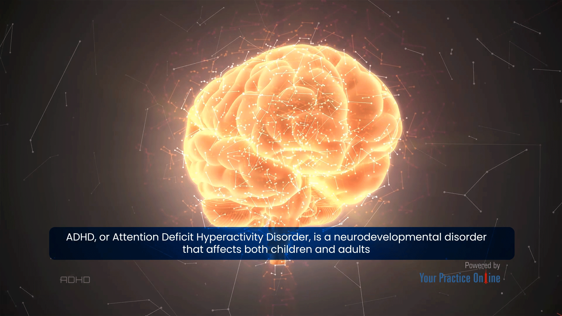 Attention Deficit Hyperactivity Disorder (ADHD) Video | Medical Video ...