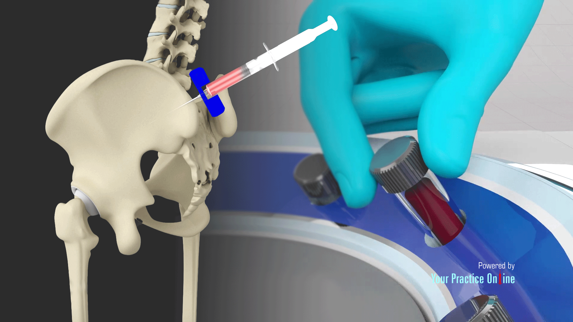 Cell Based Therapy Video | Medical Video Library