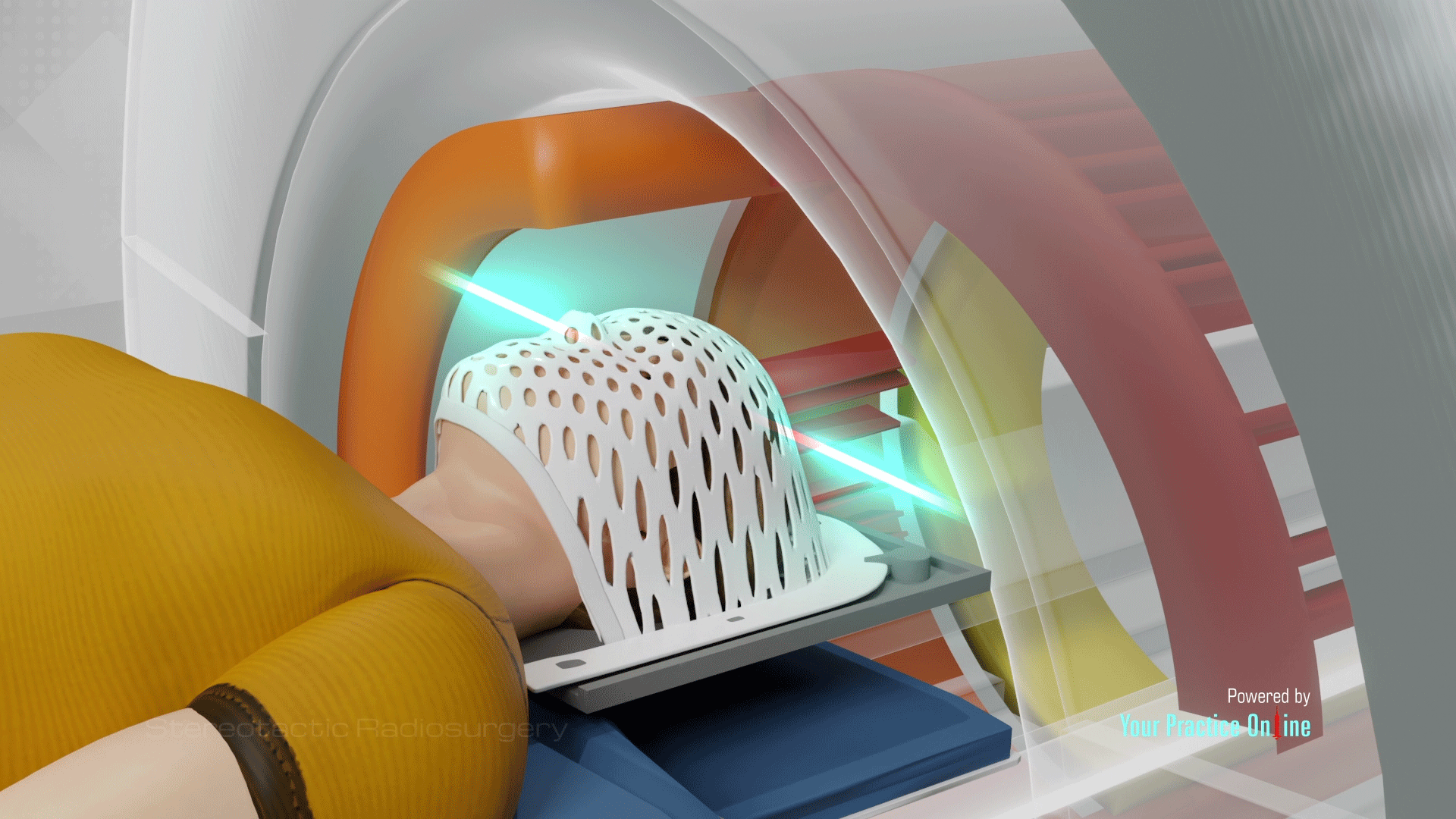 Stereotactic Radiosurgery Video | Medical Video Library