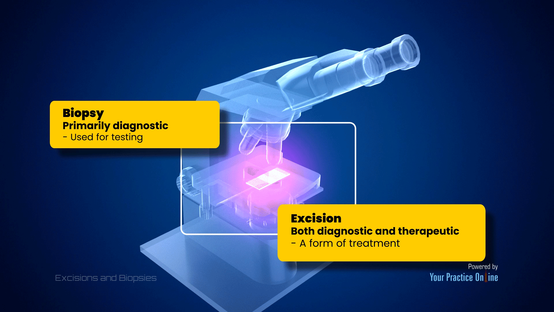 Excisions and Biopsies Video | Medical Video Library