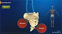 Axial Lumbar Interbody Fusion