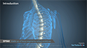 Minimally Invasive Pedicle Screw Instrumentation