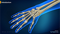 Wrist Arthroscopy