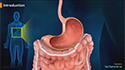 Gastritis