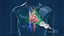 Echocardiogram