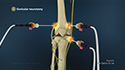 Genicular Neurotomy