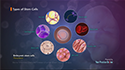 Bone Marrow Derived Mesenchymal Stem Cell Therapy