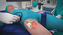 Hip Arthroscopy (Supine Position)