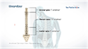 Artificial Cervical Disk Replacement