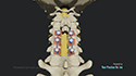 Posterior Cervical Laminectomy and Fusion