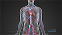 Angioplasty and Stenting (Vascular Surgery)