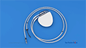 Cardiac Defibrillator Implantation