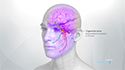 Trigeminal Neuralgia