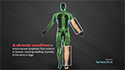 Lymphedema