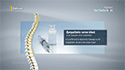 Sympathetic Nerve Block