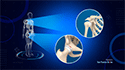 Labral Repair