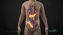 Pancreas Transplant