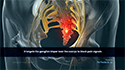 Ganglion Impar Block
