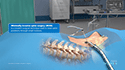 Minimally Invasive Spine Surgery